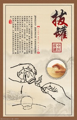 中醫(yī)拔罐理療展板