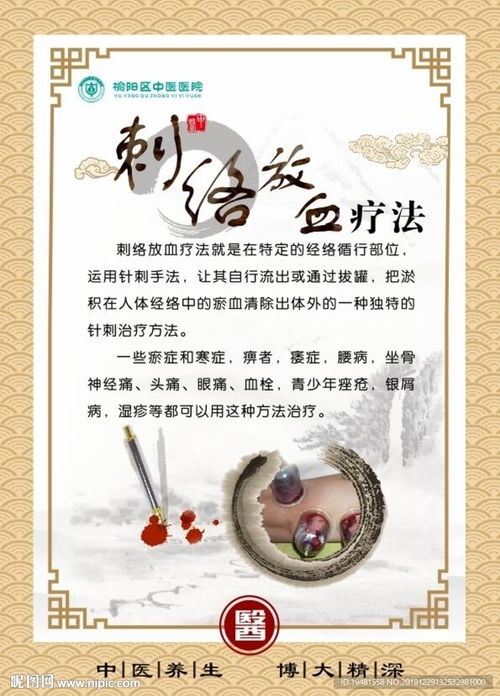 刺絡放血療法 傳統中醫的祛瘀通絡之道